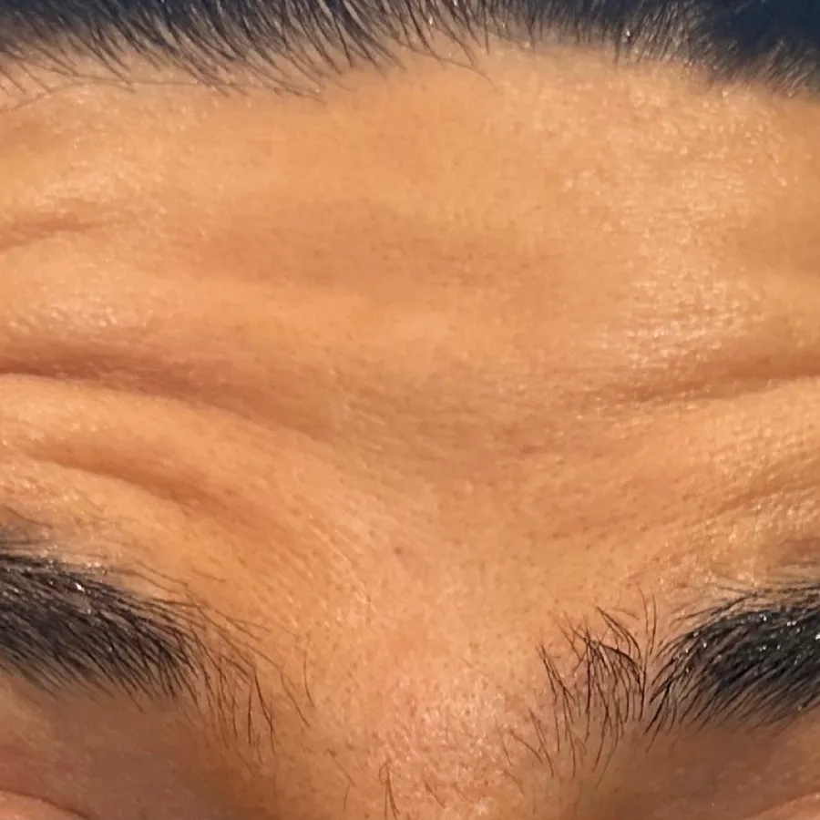 Before: wrinkle relaxer