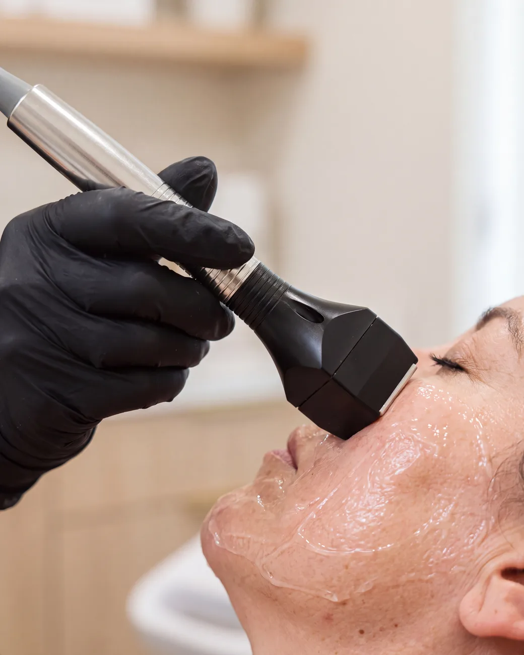 Woman relaxing during a Forma RF treatment on her forehead