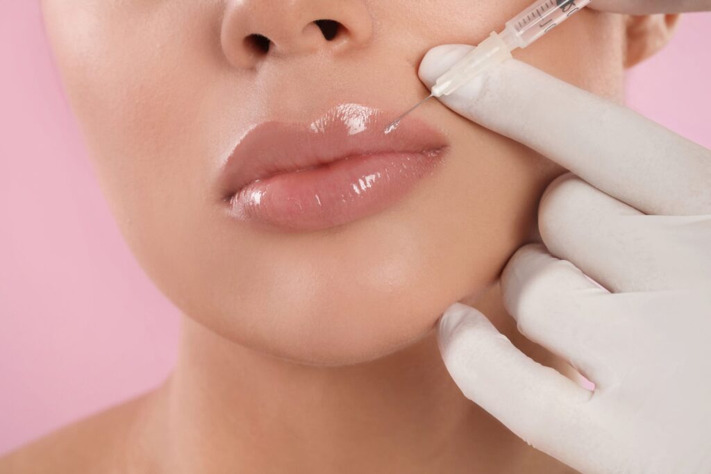 Lip Filler Dr Refresh, best lip filler West Hollywood, Dr Refresh