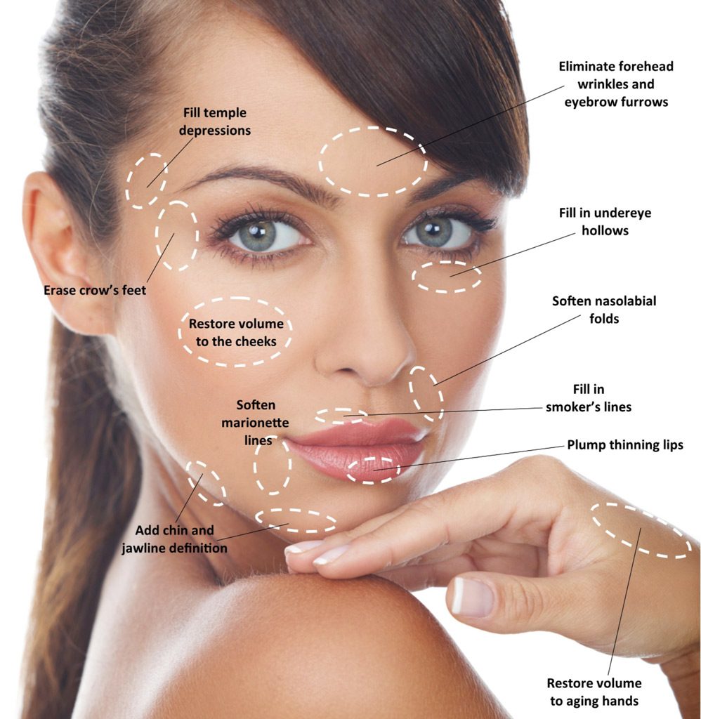 Dermal Filler locations for injections, facial filler, dr refresh, best med spa west hollywood