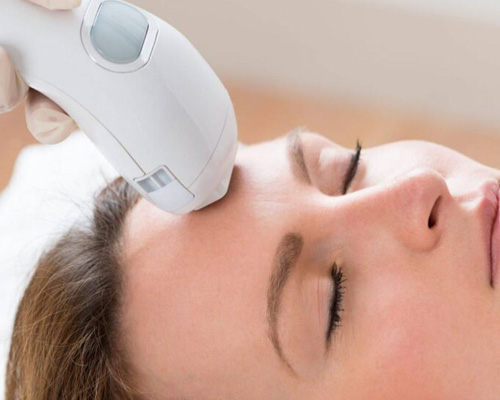 Ipl Facial