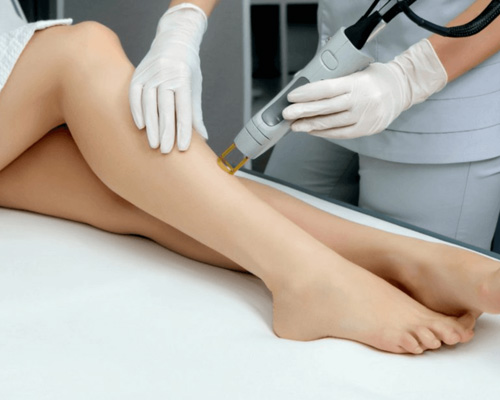 Laser Hair Removal 1