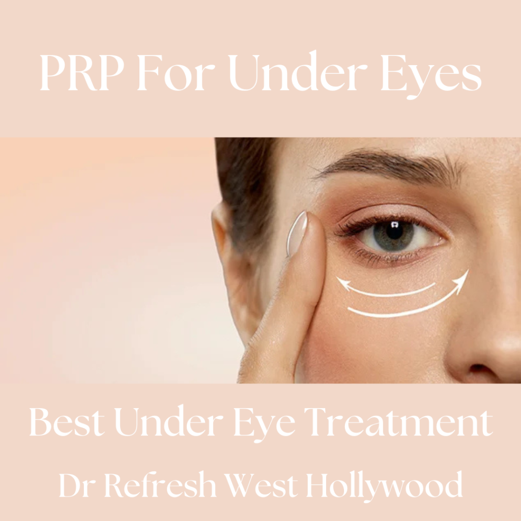 prp undereyes, under eyes bags, under eye treatment West Hollywood, prp treatments, prp for eye bags, Dr Refresh, West Hollywood